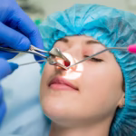 rhinoplasty cost