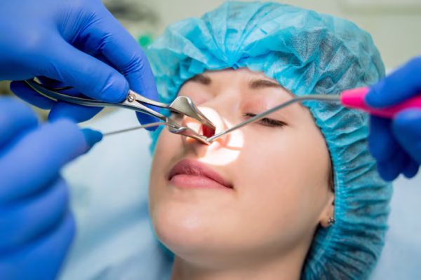 rhinoplasty cost