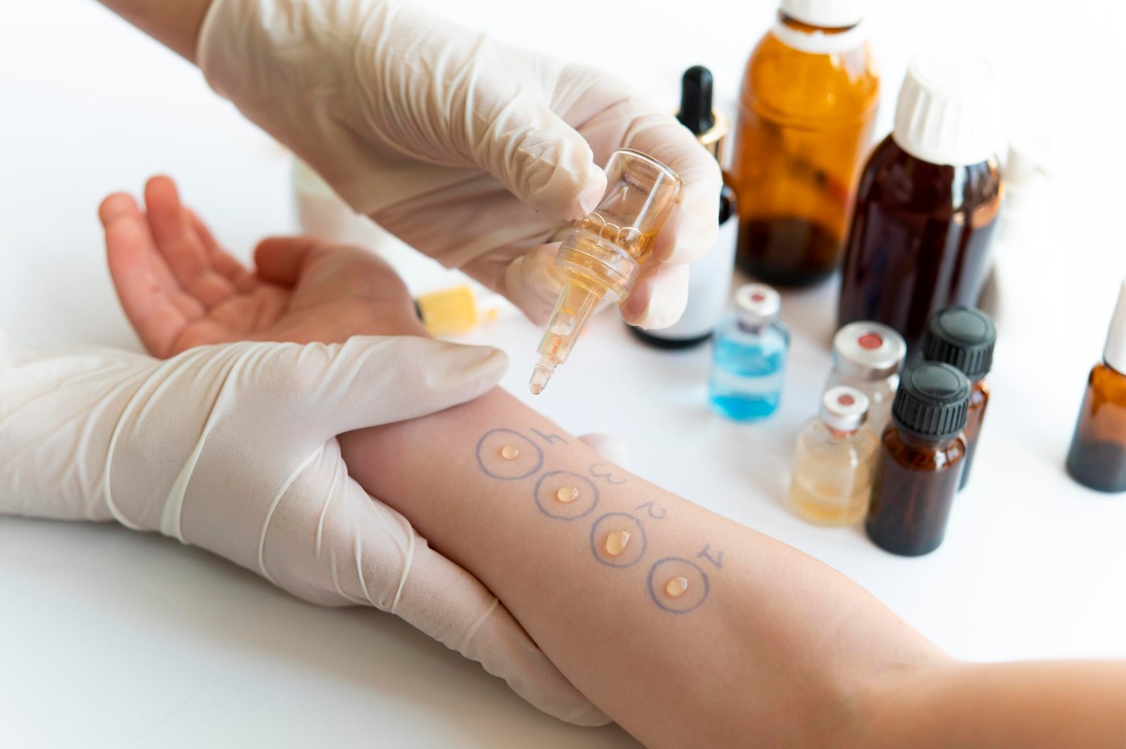 Eczedone: A Comprehensive Guide to Understanding and Managing Eczema